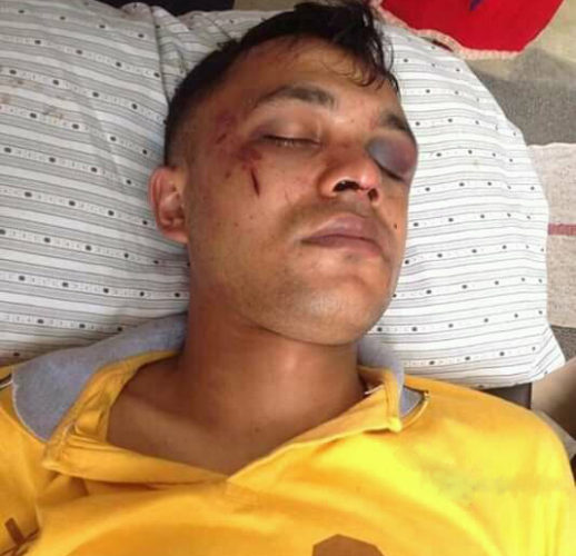 दशैँ मनाउन घर आएका प्रहरी जवानलाई कुटपिट गरी झाडिमा फालीयो