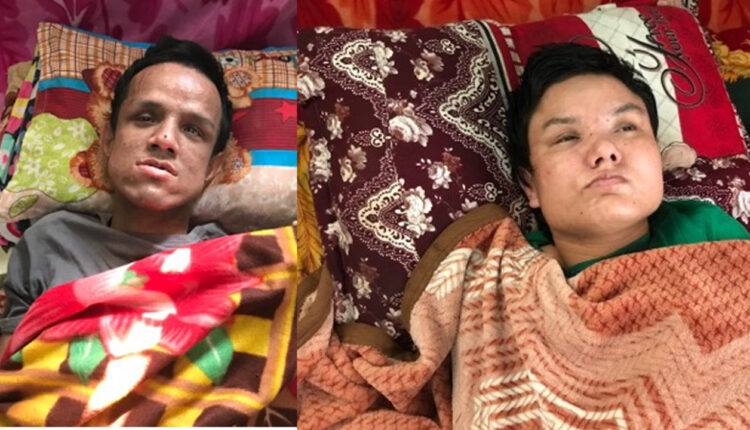 २० वर्ष भयो सुतेको, न पल्टिन सक्छन् न उठन् सके सहयोग नसके शेयर गरिदिनुहोला (भिडियोसहित)