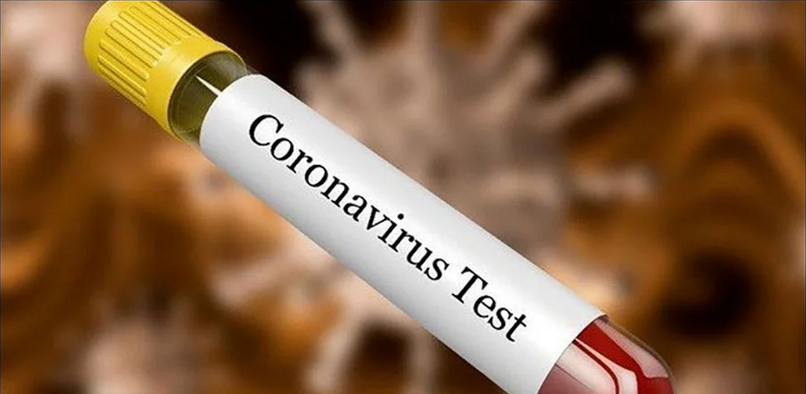 कोरोना संक्रमण देखिएका युवक कतारबाट आएर होटलमा बसेका थिए : स्वास्थ्यमन्त्री मन्त्री ढकाल