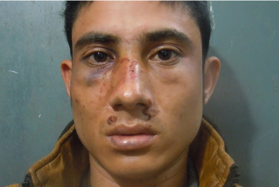 ७ वर्षअघि प्रचण्डलाई ‘थप्पड’ हान्ने पदम कुँवर फेरि पक्राउ