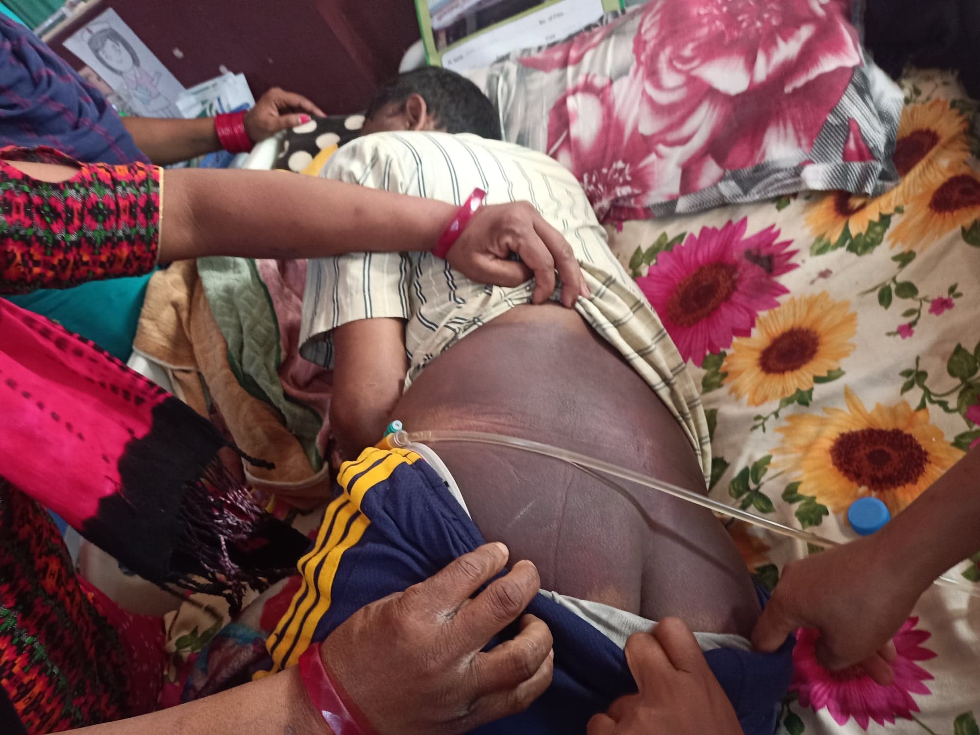प्रहरीद्वारा हिरासतमै चौधरीलाई निर्घात् कुटपिट