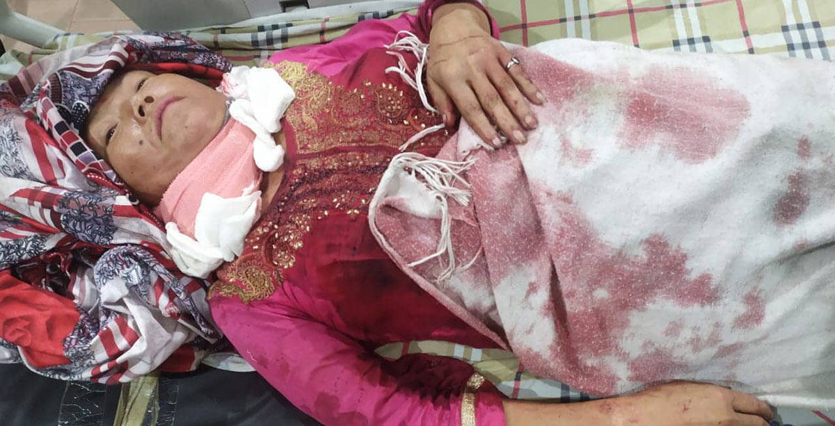 बहिनीको खुकुरी प्रहारबाट दिदी गम्भीर घाइते